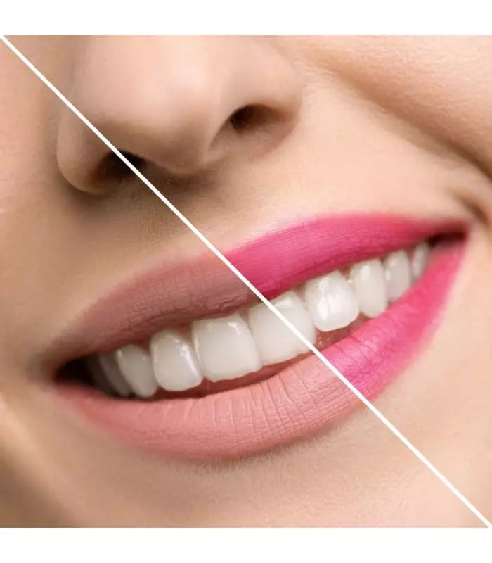 Imagem dividida ao meio de uma boca sorridente, mostrando o antes (lado esquerdo com lábios pálidos) e depois (lado direito com lábios rosa vibrante) da aplicação do bálsamo Inuwet.